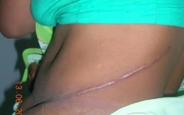 Organ harvesting in church? Find out how this Ghanaian lady lost her kidney