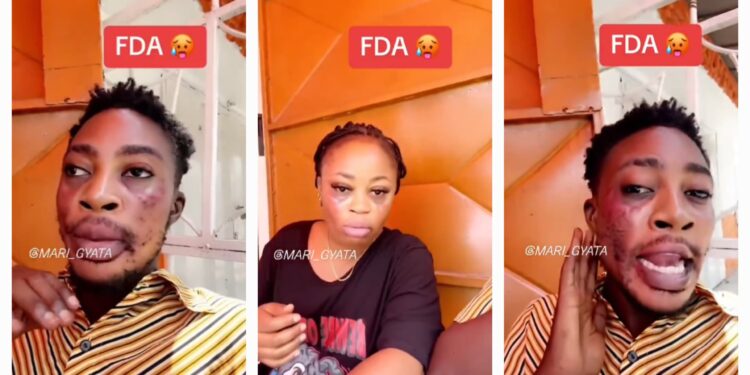 Man calls out FDA after a cream he bought destroys his face and sister’s